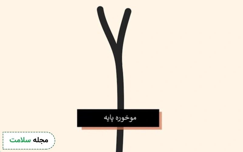 موخوره پایه چیست؟