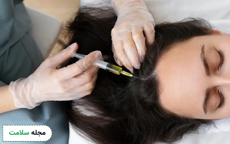 سن مناسب مزوتراپی مو کی است؟