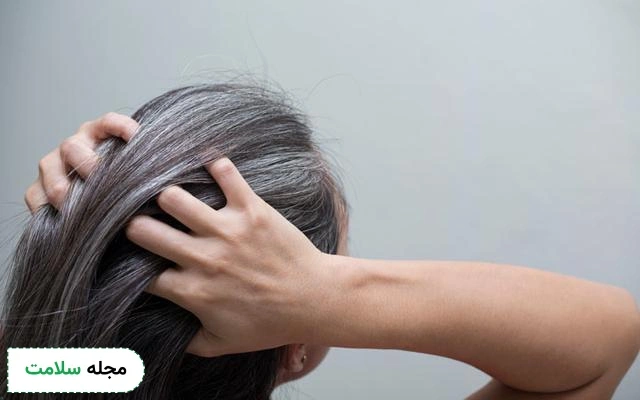 موی سفید در جوانی نشانه چیست و چگونه آن را درمان کنیم؟