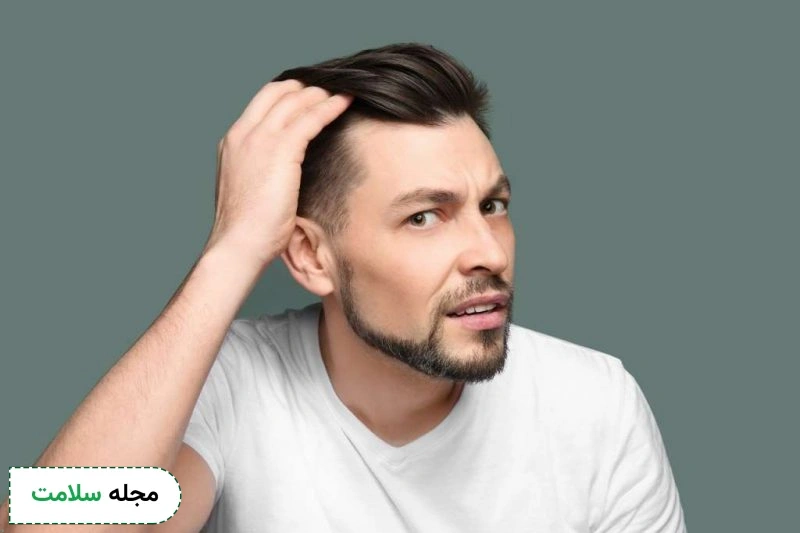 علت ریزش مو در مردان چیست؟
