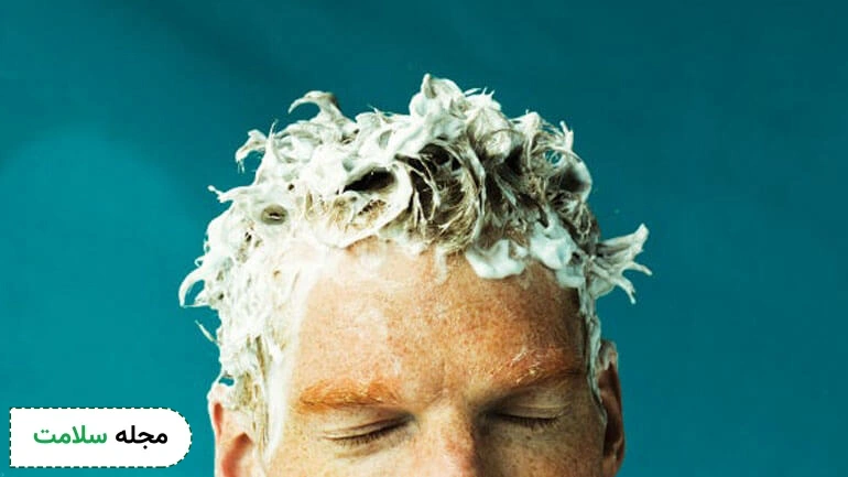 greasy hair treatment