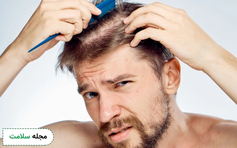 بهترین قرص ویتامین برای ریزش مو چیست؟