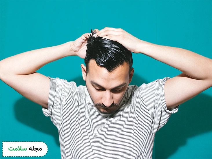 علل-ریزش-مو-در-مردان