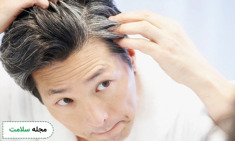 gray hair in youth