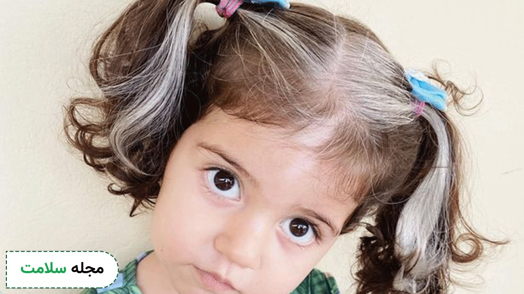 white hair in kids