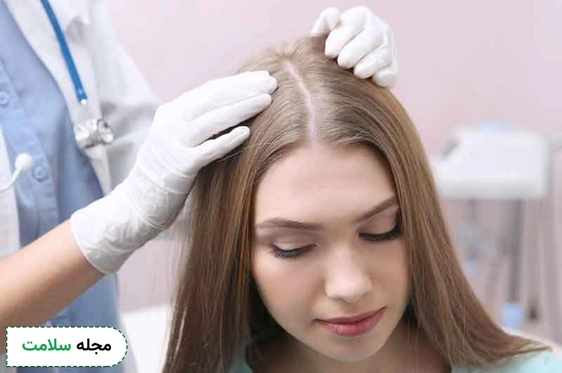 Cause-of-fine-hair-in-women