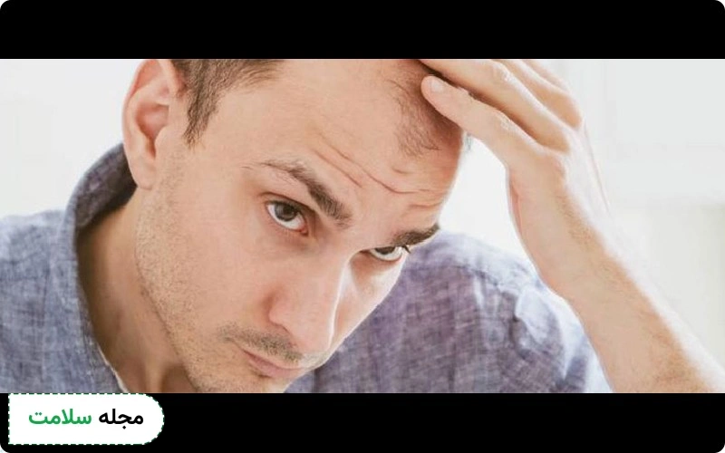 پروتز مو برای چه کسانی مفید است؟