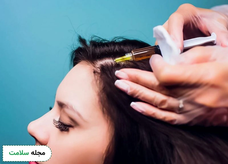 درمان ریزش مو زنان | 15 روش درمان ریزش مو در زنان