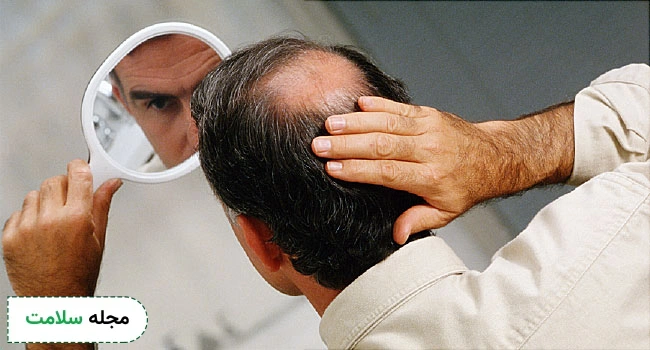 کچلی-مردان