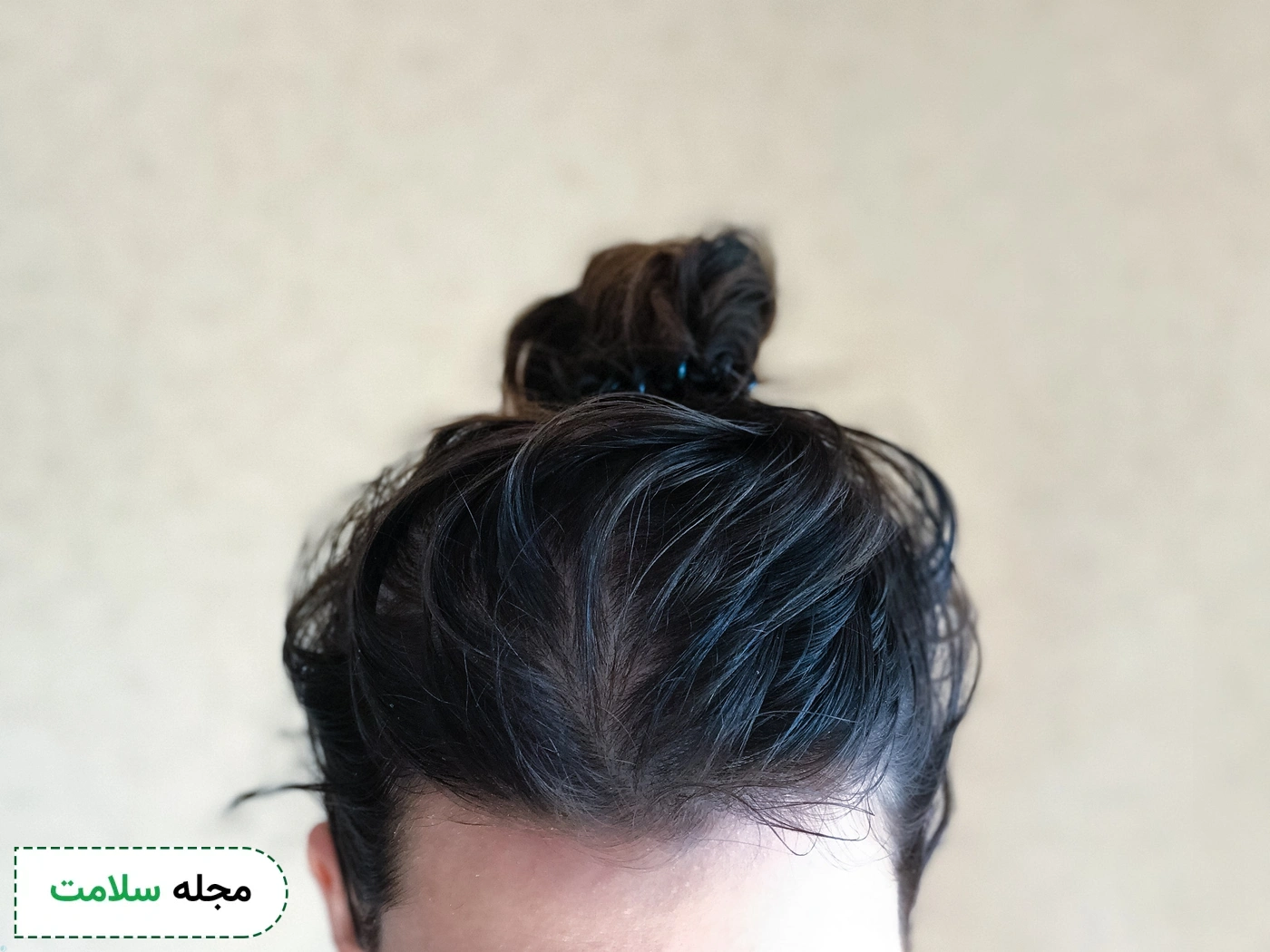 greasy hair treatment