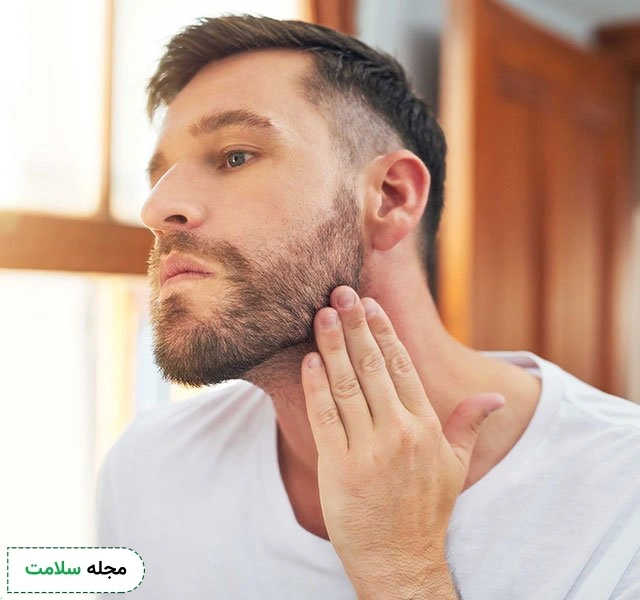 beard-hair-loss