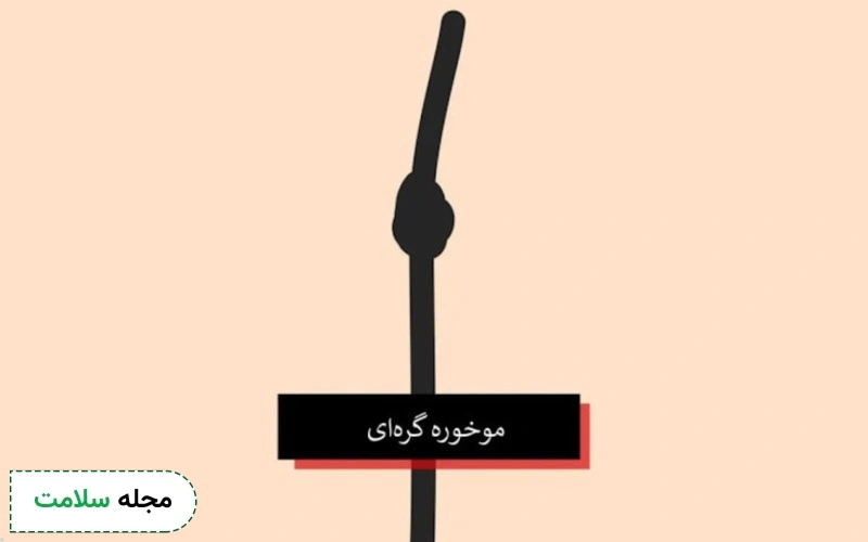 موخوره گره ای چیست؟